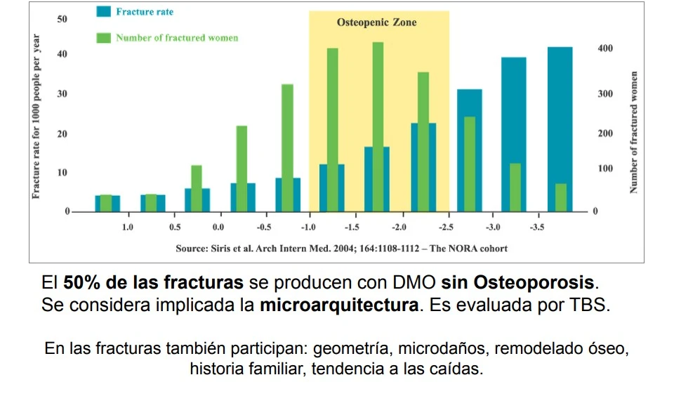 Trabecular bone score - Revisión